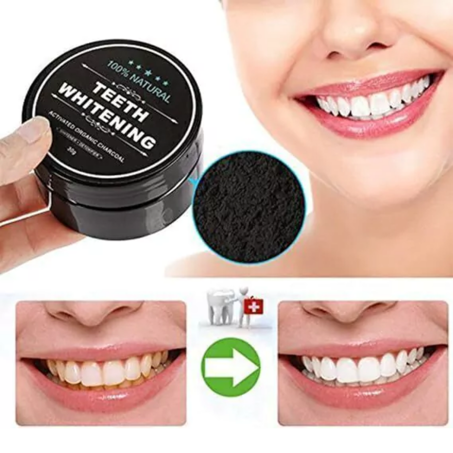 Carbón Coco® - Blanqueador Dental Acción Inmediata