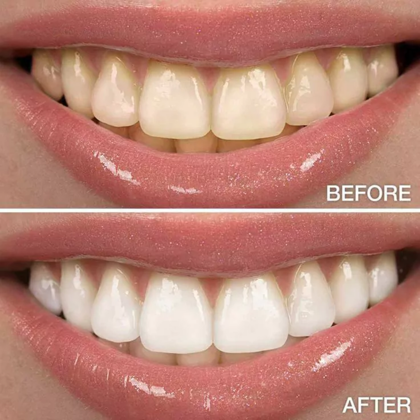 Carbón Coco® - Blanqueador Dental Acción Inmediata